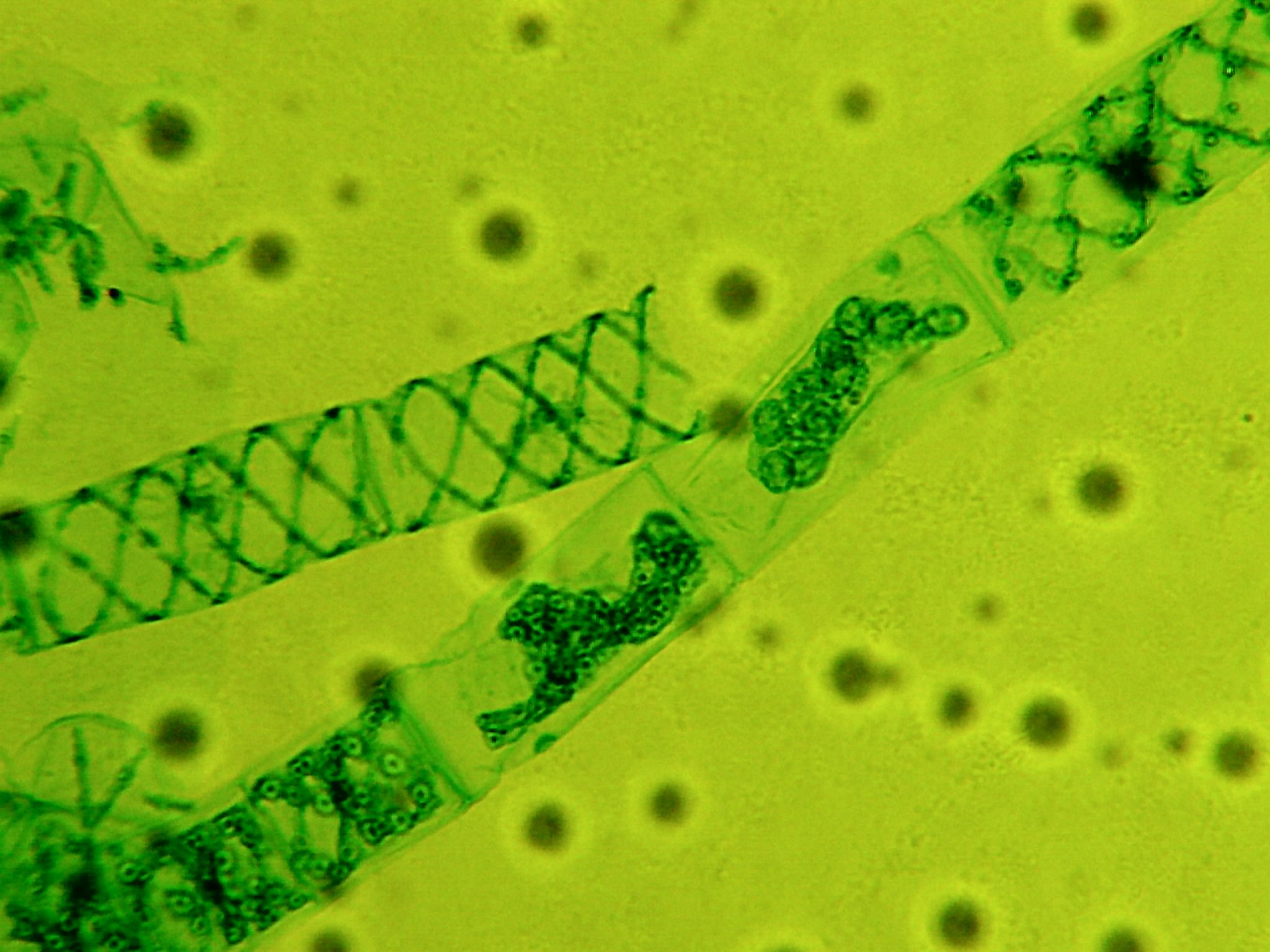 Бактерия водоросль простейшие. Спирогира в микроскопе. Водоросль спирогира в микроскопе. Цианобактерии одноклеточные водоросли. Водоросль спирогира под микроскопом.